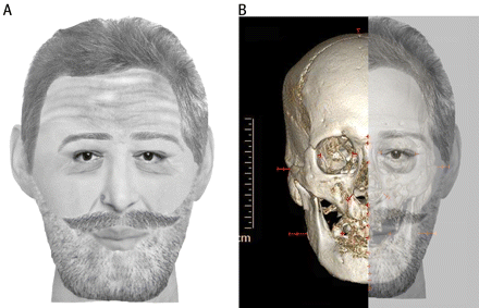 Henri IV : reconstitution faciale du crâne retrouvé